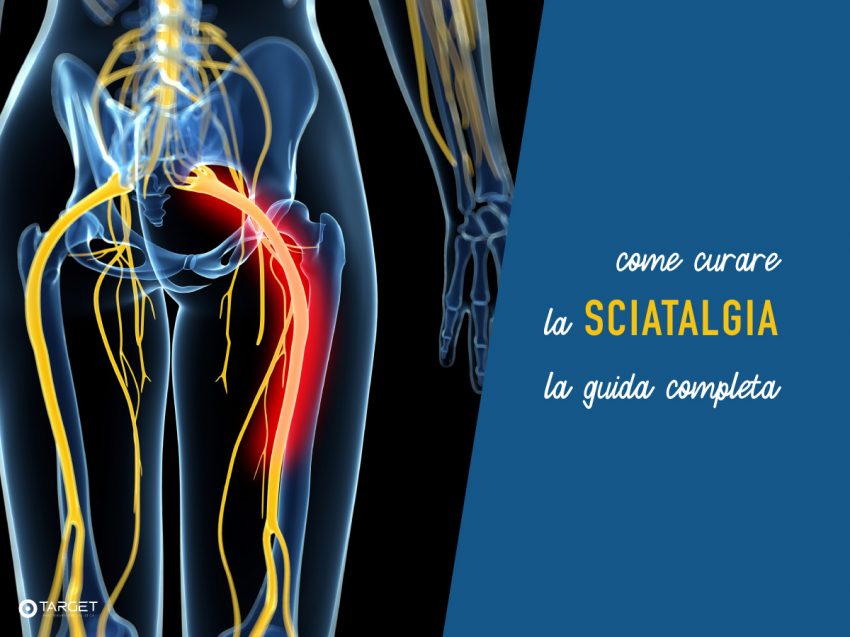 come curare la sciatalgia