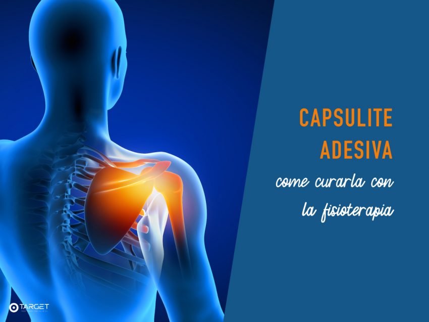 capsulite adesiva e fisioterapia