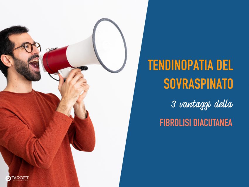 tendinite-sovraspinato-fibrolisi-diacutanea